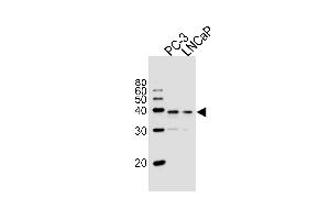 Western blot analysis of lysates from PC-3, LNCaP cell line (from left to right), using VDR Antibody at 1:1000 at each lane. (VD (AA 274-299) antibody)