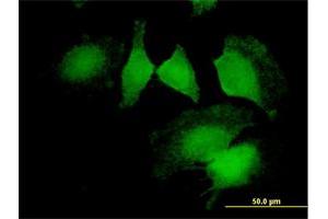 Immunofluorescence of purified MaxPab antibody to CNN2 on HeLa cell. (CNN2 antibody  (AA 1-270))