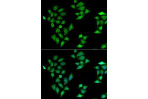 Immunofluorescence analysis of HeLa cell using ITLN1 antibody. (ITLN1/Omentin antibody)