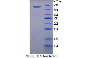 SDS-PAGE analysis of Human TGM1 Protein. (TGM1 Protein)