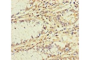 BCMO1 antibody  (AA 1-300)