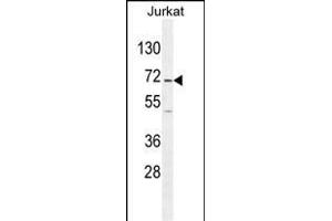 GAD2 Antibody (Center) (ABIN655070 and ABIN2844700) western blot analysis in Jurkat cell line lysates (35 μg/lane). (GAD65 antibody  (AA 109-138))