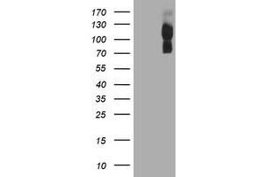 HEK293T cells were transfected with the pCMV6-ENTRY control (Left lane) or pCMV6-ENTRY ENPEP (Right lane) cDNA for 48 hrs and lysed. (ENPEP antibody)