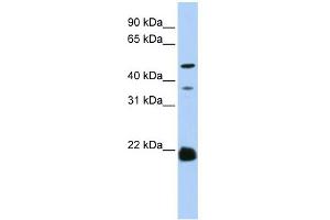 WB Suggested Anti-ZDHHC14 Antibody Titration:  0. (ZDHHC14 antibody  (N-Term))