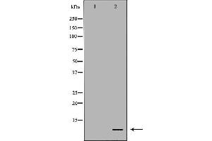 DEFB121 antibody  (Internal Region)