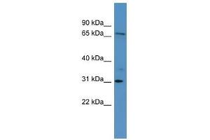 Western Blot showing RGL3 antibody used at a concentration of 1-2 ug/ml to detect its target protein. (RGL3 antibody  (Middle Region))