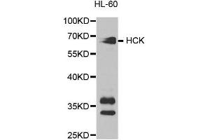 Western blot analysis of extracts of HL-60 cell lines, using HCK antibody. (HCK antibody  (AA 1-220))