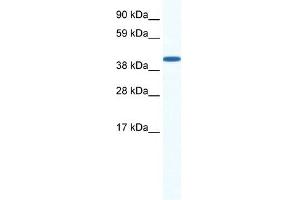 WB Suggested Anti-ZFP36L1 Antibody Titration: 0.