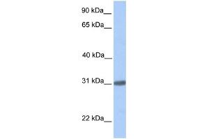 WB Suggested Anti-C7orf61 Antibody Titration: 0. (C7orf61 antibody  (C-Term))