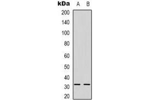 Western blot analysis of NGF beta expression in Raji (A), HepG2 (B) whole cell lysates.