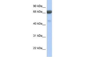 PNMA3 antibody used at 1 ug/ml to detect target protein. (PNMA3 antibody  (Middle Region))