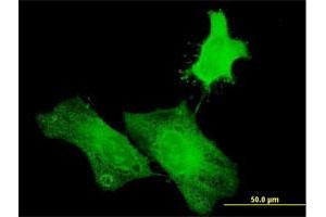 Immunofluorescence of purified MaxPab antibody to H1FOO on HeLa cell. (H1FOO antibody  (AA 1-207))