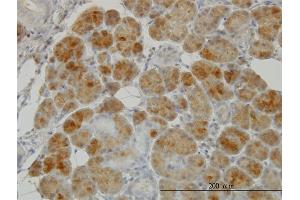 Immunostaining (ISt) image for anti-Glutathione Reductase (GSR) (AA 413-522) antibody (ABIN561156)
