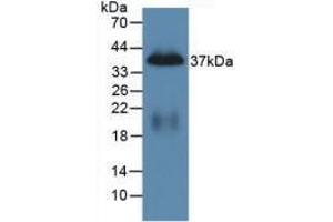 Western blot analysis of recombinant Mouse PP. (PPY antibody  (AA 31-97))