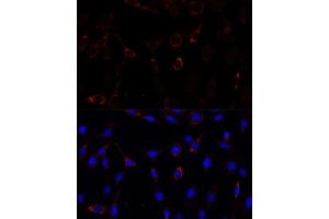 Immunofluorescence analysis of C6 cells using RNF112 antibody (ABIN7270054) at dilution of 1:100. (RNF112 antibody  (AA 200-500))