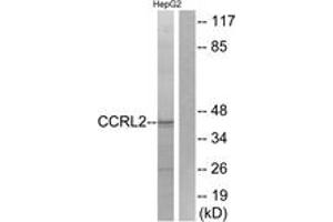 Western blot analysis of extracts from HepG2 cells, using CCRL2 Antibody. (CCRL2 antibody  (AA 141-190))