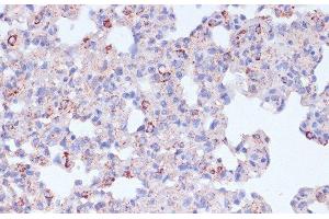 Immunohistochemistry of paraffin-embedded Rat lung using CD18 Polyclonal Antibody at dilution of 1:100 (40x lens). (Integrin beta 2 antibody)