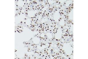 Immunohistochemistry (IHC) image for anti-GATA Binding Protein 4 (GATA4) (AA 50-150) antibody (ABIN6140975)