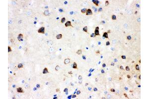 Anti- SSH3BP1 Picoband antibody, IHC(P) IHC(P): Mouse Brain Tissue (ABI1 antibody  (N-Term))