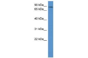 WB Suggested Anti-ADD3 Antibody Titration: 0. (ADD3 antibody  (C-Term))