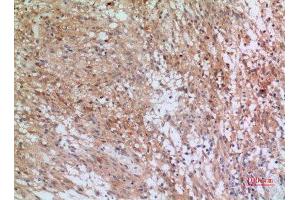 Immunohistochemistry (IHC) analysis of paraffin-embedded Human Brain, antibody was diluted at 1:100. (INHBB antibody  (C-Term))