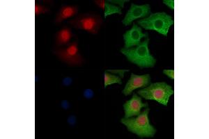ABIN6256503 and ABIN6267060 staining Hela cells by IF/ICC.