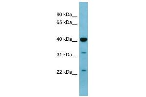 WB Suggested Anti-MAPK3 Antibody Titration: 0. (ERK1 antibody  (Middle Region))