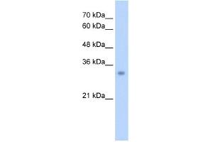 WB Suggested Anti-ECH1 Antibody Titration:  2. (ECH1 antibody  (N-Term))