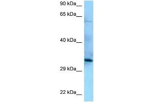 WB Suggested Anti-PPP6C Antibody Titration: 1. (PPP6C antibody  (N-Term))
