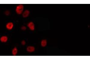 ABIN6274294 staining Hela cells by IF/ICC. (ELL antibody  (Internal Region))