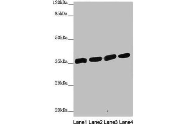 ANKRD1 antibody  (AA 1-130)