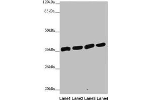 Western blot All lanes: ANKRD1 antibody at 1. (ANKRD1 antibody  (AA 1-130))