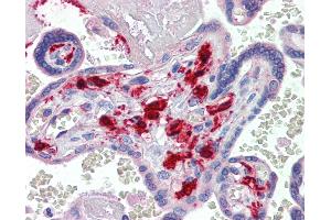 Anti-F13A1 / Factor XIIIa antibody IHC of human placenta. (F13A1 antibody)