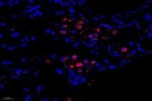 Immunofluorescent analysis of paraformaldehyde-fixed human lung using,FLJ22167 (ABIN7073961) at dilution of 1: 1400 (FLJ22167 antibody)