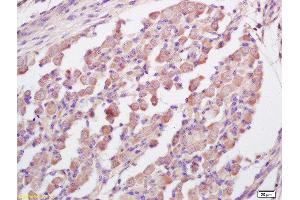 Formalin-fixed and paraffin embedded mouse embryo labeled with Anti-RNF123 Polyclonal Antibody, Unconjugated  at 1:200 followed by conjugation to the secondary antibody and DAB staining (RNF123 antibody  (AA 2-52))