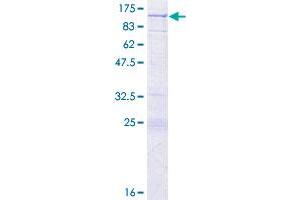 KRIT1 Protein (AA 1-736) (GST tag)