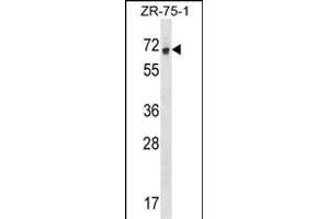 RCOR1 Antibody (N-term) (ABIN1538927 and ABIN2848670) western blot analysis in ZR-75-1 cell line lysates (35 μg/lane). (CoREST antibody  (N-Term))