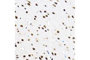 Immunohistochemistry of paraffin-embedded rat brain using SF3 Rabbit pAb (ABIN1682671, ABIN3018959, ABIN3018960 and ABIN6220644) at dilution of 1:100 (40x lens).