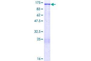 BCAR1 Protein (AA 1-870) (GST tag)