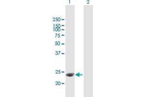 Western Blot analysis of C1QTNF3 expression in transfected 293T cell line by C1QTNF3 MaxPab polyclonal antibody. (C1QTNF3 antibody  (AA 1-246))