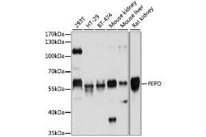 Western blot analysis of extracts of various cell lines, using PEPD antibody. (PEPD antibody  (AA 288-424))
