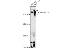 Western blot analysis of extracts of various cell lines, using MRP2/ antibody (ABIN6129853, ABIN6136357, ABIN6136358 and ABIN6224455) at 1:1000 dilution. (ABCC2 antibody  (AA 180-315))