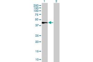 Western Blot analysis of IFNAR2 expression in transfected 293T cell line by IFNAR2 MaxPab polyclonal antibody. (IFNAR2 antibody  (AA 1-331))