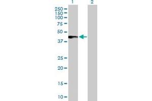 Western Blot analysis of IFNAR2 expression in transfected 293T cell line by IFNAR2 MaxPab polyclonal antibody.