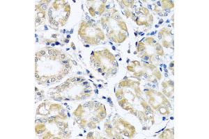 Immunohistochemistry of paraffin-embedded human stomach using NDUFB10 antibody (ABIN5972156) at dilution of 1/100 (40x lens). (NDUFB10 antibody)