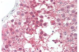 Rabbit Anti-BRD4 antibody  Formalin Fixed Paraffin Embedded Tissue: Human Testis Primary antibody Concentration: 1:100 Secondary Antibody: Donkey anti-Rabbit-Cy3 Secondary Antibody Concentration: 1:200 Magnification: 20x Exposure Time: 0. (BRDT antibody  (N-Term))
