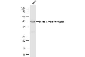 Liver lysates probed withAACT Alpha1 Polyclonal Antibody, Unconjugated  at 1:500 dilution and 4˚C overnight incubation. (SERPINA3 antibody  (AA 121-320))