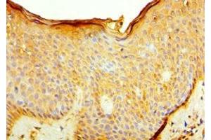 Immunohistochemistry of paraffin-embedded human skin tissue using ABIN7156926 at dilution of 1:100 (IL7R antibody  (AA 21-239))