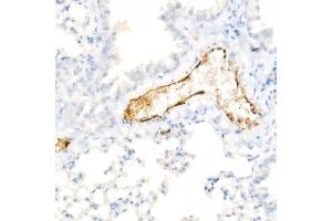 Immunohistochemistry of paraffin-embedded Mouse lung using von Willebrand factor (VWF) antibody (ABIN7271339) at dilution of 1:800 (40x lens). (VWF antibody)