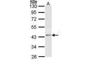Image no. 2 for anti-Thyroid Hormone Receptor, beta (THRB) (AA 1-169) antibody (ABIN467595) (THRB antibody  (AA 1-169))